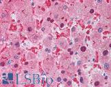 XIAP Antibody - Anti-XIAP antibody IHC of human liver. Immunohistochemistry of formalin-fixed, paraffin-embedded tissue after heat-induced antigen retrieval. Antibody concentration 2 ug/ml.
