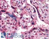 ZBTB7B / HcKrox Antibody - Anti-ZBTB7B antibody IHC of human placenta. Immunohistochemistry of formalin-fixed, paraffin-embedded tissue after heat-induced antigen retrieval. Antibody dilution 1:200.