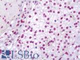 ZC3H12A / MCPIP1 Antibody - Anti-ZC3H12A / MCPIP1 antibody IHC staining of human adrenal. Immunohistochemistry of formalin-fixed, paraffin-embedded tissue after heat-induced antigen retrieval. Antibody dilution 1:100.