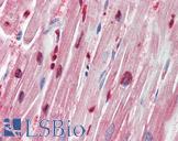 ZEB1 / AREB6 Antibody - Human Heart: Formalin-Fixed, Paraffin-Embedded (FFPE)