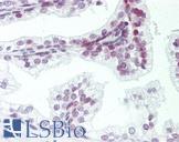 ZMYM6 Antibody - Human Prostate: Formalin-Fixed, Paraffin-Embedded (FFPE).  This image was taken for the unconjugated form of this product. Other forms have not been tested.