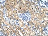 IHH Antibody - IHC of FFPE human kidney. Positive cells: Epithelial cells of renal tubule.  This image was taken for the unconjugated form of this product. Other forms have not been tested.