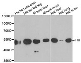 IHH Antibody - Western blot analysis of extracts of various cell lines, using IHH antibody.