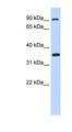 IKBKB / IKK2 / IKK Beta Antibody - IKBKB / IKK Beta antibody Western blot of Fetal Brain lysate. This image was taken for the unconjugated form of this product. Other forms have not been tested.
