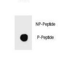 IKBKB / IKK2 / IKK Beta Antibody - Dot blot of Phospho-IKKB-S466 Antibody Phospho-specific antibody on nitrocellulose membrane. 50ng of Phospho-peptide or Non Phospho-peptide per dot were adsorbed. Antibody working concentrations are 0.6ug per ml.