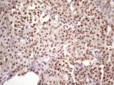 IKBKE / IKKI / IKKE Antibody - IHC of paraffin-embedded Human pancreas tissue using anti-IKBKE mouse monoclonal antibody. (Heat-induced epitope retrieval by 1 mM EDTA in 10mM Tris, pH8.5, 120°C for 3min)(1:150).