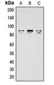 Antibody - Western blot analysis of IKK alpha/beta (pS176/177) expression in HeLa LPS-treated (A); mouse brain (B); rat brain (C) whole cell lysates.