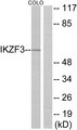 IKZF3 / AIOLOS Antibody - Western blot analysis of lysates from COLO cells, using IKZF3 Antibody. The lane on the right is blocked with the synthesized peptide.