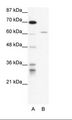 IKZF4 / EOS Antibody - A: Marker, B: HepG2 Cell Lysate.  This image was taken for the unconjugated form of this product. Other forms have not been tested.