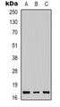 IL-1B / IL-1 Beta Antibody - Western blot analysis of IL-1 beta expression in HeLa (A); SHSY5Y (B); mouse liver (C) whole cell lysates.