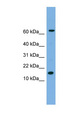 IL-1B / IL-1 Beta Antibody - IL1B / IL1 Beta antibody Western blot of HeLa lysate. This image was taken for the unconjugated form of this product. Other forms have not been tested.