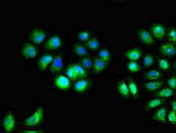 IL10RA Antibody - Immunofluorescent analysis of A549 cells diluted at 1:100 and Alexa Fluor 488-congugated AffiniPure Goat Anti-Rabbit IgG(H+L)