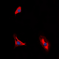IL10RA Antibody - Immunofluorescent analysis of CD210a staining in HUVEC cells. Formalin-fixed cells were permeabilized with 0.1% Triton X-100 in TBS for 5-10 minutes and blocked with 3% BSA-PBS for 30 minutes at room temperature. Cells were probed with the primary antibody in 3% BSA-PBS and incubated overnight at 4 ??C in a humidified chamber. Cells were washed with PBST and incubated with a DyLight 594-conjugated secondary antibody (red) in PBS at room temperature in the dark. DAPI was used to stain the cell nuclei (blue).