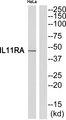 IL11RA Antibody - Western blot analysis of extracts from HeLa cells, using IL11RA antibody.