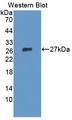 IL12A / p35 Antibody - Western blot of IL12A / p35 antibody.