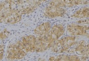 IL12B / IL12 p40 Antibody - 1:100 staining human uterus tissue by IHC-P. The sample was formaldehyde fixed and a heat mediated antigen retrieval step in citrate buffer was performed. The sample was then blocked and incubated with the antibody for 1.5 hours at 22°C. An HRP conjugated goat anti-rabbit antibody was used as the secondary.