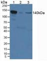 IL12RB2 Antibody - Western Blot; Sample: Lane1: Mouse Serum; Lane2: Mouse Placenta Tissue; Lane3: Human Hela Cells.