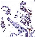 IL13 Antibody - IL13 Antibody immunohistochemistry of formalin-fixed and paraffin-embedded human lung tissue followed by peroxidase-conjugated secondary antibody and DAB staining.