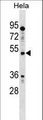 IL13RA1 / IL13R Alpha 1 Antibody - IL13RA1 Antibody western blot of HeLa cell line lysates (35 ug/lane). The IL13RA1 antibody detected the IL13RA1 protein (arrow).