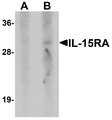 IL15RA Antibody - Western blot analysis of IL-15RA in human small intestine tissue lysate with IL-15RA antibody at (A) 1 and (B) 2 ug/ml