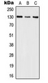 IL16 Antibody - Western blot analysis of IL-16 expression in MCF7 (A); Raji (B); mouse brain (C) whole cell lysates.