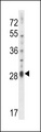 IL17D Antibody - IL17D Antibody western blot of NCI-H460 cell line lysates (35 ug/lane). The IL17D antibody detected the IL17D protein (arrow).