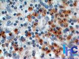 IL17RA Antibody - Immunohistochemistry-Paraffin: IL17RA Antibody (49M4D2) - Formalin-fixed, paraffin-embedded human spleen stained with IL-17RA antibody (1 ug/ml), peroxidase-conjugate and DAB chromogen. TMA was used for this test.