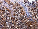 IL17RC Antibody - Immunohistochemistry of paraffin-embedded Human tonsil using IL17RC Polyclonal Antibody at dilution of 1:30.