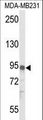 IL17RD Antibody - Western blot of IL17RD Antibody in MDA-MB231 cell line lysates (35 ug/lane). IL17RD (arrow) was detected using the purified antibody.