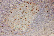 IL18 Antibody - IL18 antibody. IHC(P): Human Tonsil Tissue.