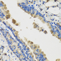IL1F9 Antibody - Immunohistochemistry of paraffin-embedded mouse lung tissue.