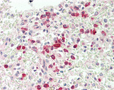 IL1R1 Antibody - Human Spleen: Formalin-Fixed, Paraffin-Embedded (FFPE).  This image was taken for the unconjugated form of this product. Other forms have not been tested.
