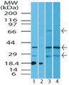 IL1RL1 Antibody - Western blot of ST2 protein in human kidney lysate in the 1) absence and 2) presence of immunizing peptide, 3) mouse kidney and 4) rat kidney lysate using Polyclonal Antibody to ST2/IL1RL1 at 4.0 ug/ml. Goat anti-rabbit Ig HRP secondary antibody, and PicoTect ECL substrate solution, were used for this test.