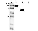 IL1RL1 Antibody - Western blot analysis of recombinant human soluble ST2 using anti-ST2 (human), mAb (ST33868) at 1:2,000 dilution. . 1. Recombinant human soluble ST2-Fc protein. . 2. Recombinant human soluble ST2-FLAG protein. . 3. Recombinant mouse Resistin-Fc protein (Negative control).