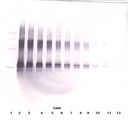 IL2 Antibody - Western Blot (reducing) of IL-2 antibody. This image was taken for the unconjugated form of this product. Other forms have not been tested.