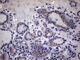 IL20 Antibody - IHC of paraffin-embedded Human thyroid tissue using anti-IL20 mouse monoclonal antibody. (Heat-induced epitope retrieval by 1 mM EDTA in 10mM Tris, pH8.5, 120°C for 3min).