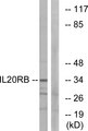 IL20RB Antibody - Western blot analysis of lysates from HeLa cells, using IL20RB Antibody. The lane on the right is blocked with the synthesized peptide.