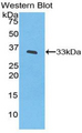 IL20RB Antibody - Western blot of recombinant IL20RB.  This image was taken for the unconjugated form of this product. Other forms have not been tested.