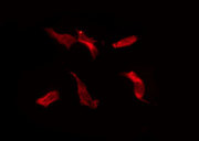 IL20RB Antibody - Staining HeLa cells by IF/ICC. The samples were fixed with PFA and permeabilized in 0.1% Triton X-100, then blocked in 10% serum for 45 min at 25°C. The primary antibody was diluted at 1:200 and incubated with the sample for 1 hour at 37°C. An Alexa Fluor 594 conjugated goat anti-rabbit IgG (H+L) Ab, diluted at 1/600, was used as the secondary antibody.
