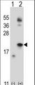 IL21 Antibody - Western blot of IL21 (arrow) using rabbit polyclonal IL21 Antibody. 293 cell lysates (2 ug/lane) either nontransfected (Lane 1) or transiently transfected (Lane 2) with the IL21 gene.