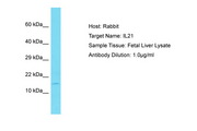 IL21 Antibody -  This image was taken for the unconjugated form of this product. Other forms have not been tested.