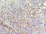 IL22RA1 / IL22R Antibody - Immunohistochemistry of paraffin-embedded human tonsil using antibody at 1:100 dilution.