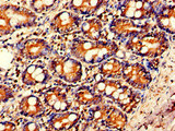 IL23A / IL-23 p19 Antibody - Immunohistochemistry of paraffin-embedded human small intestine tissue at dilution of 1:100