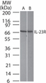 IL23R Antibody - Western blot of IL-23R in (A) Jurkat and (B) NIH3T3 cell lysate using antibody at 0.5 ug/ml.