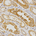 IL23R Antibody - Immunohistochemistry of paraffin-embedded human kidney using IL23R antibody at dilution of 1:200 (x400 lens).