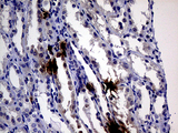 IL24 Antibody - Immunohistochemical staining of paraffin-embedded Human Kidney tissue within the normal limits using anti-IL24 mouse monoclonal antibody. (Heat-induced epitope retrieval by 1mM EDTA in 10mM Tris buffer. (pH8.5) at 120°C for 3 min. (1:2000)