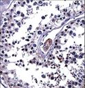 IL25 / IL17E Antibody - IL25 Antibody immunohistochemistry of formalin-fixed and paraffin-embedded human testis tissue followed by peroxidase-conjugated secondary antibody and DAB staining.
