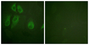 IL2RA / CD25 Antibody - Immunofluorescence analysis of HeLa cells, using IL-2R alpha/CD25 Antibody. The picture on the right is blocked with the synthesized peptide.