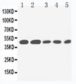 IL2RG / CD132 Antibody - WB of IL2RG / CD132 antibody. All lanes: Anti-IL2RG at 0.5ug/ml. Lane 1: PANC Whole Cell Lysate at 40ug. Lane 2: HELA Whole Cell Lysate at 40ug. Lane 3: JURKAT Whole Cell Lysate at 40ug. Lane 4: RAJI Whole Cell Lysate at 40ug. Lane 5: CEM Whole Cell Lysate at 40ug. Predicted bind size: 42KD. Observed bind size: 42KD.