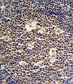 IL4 Antibody - IL4 Antibody IHC of formalin-fixed and paraffin-embedded tonsil followed by peroxidase-conjugated secondary antibody and DAB staining.